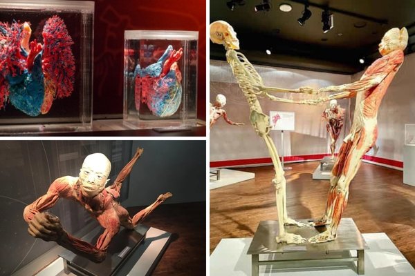 REAL Bodies at Horseshoe Las Vegas Budget Tickets - Numerous displays of human bodies are featured with educational signage and sets.